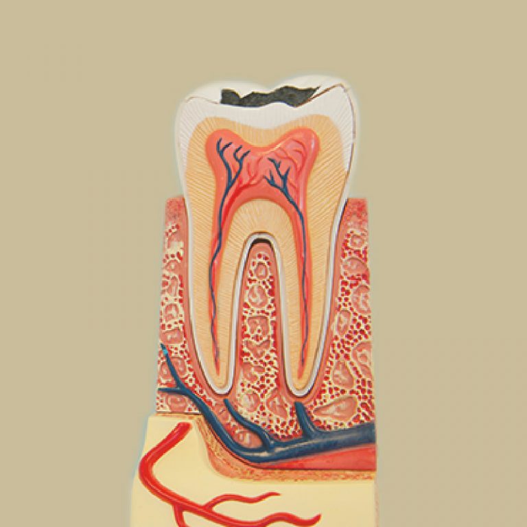 博誠牙醫，永和牙根治療