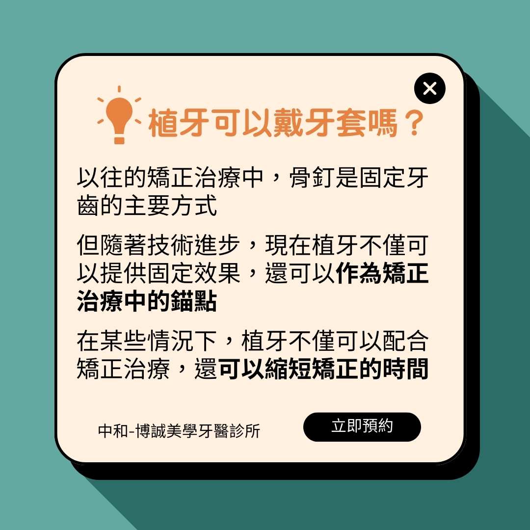 植牙可以戴牙套，甚至可以作為牙齒矯正的錨點，縮短矯正時間