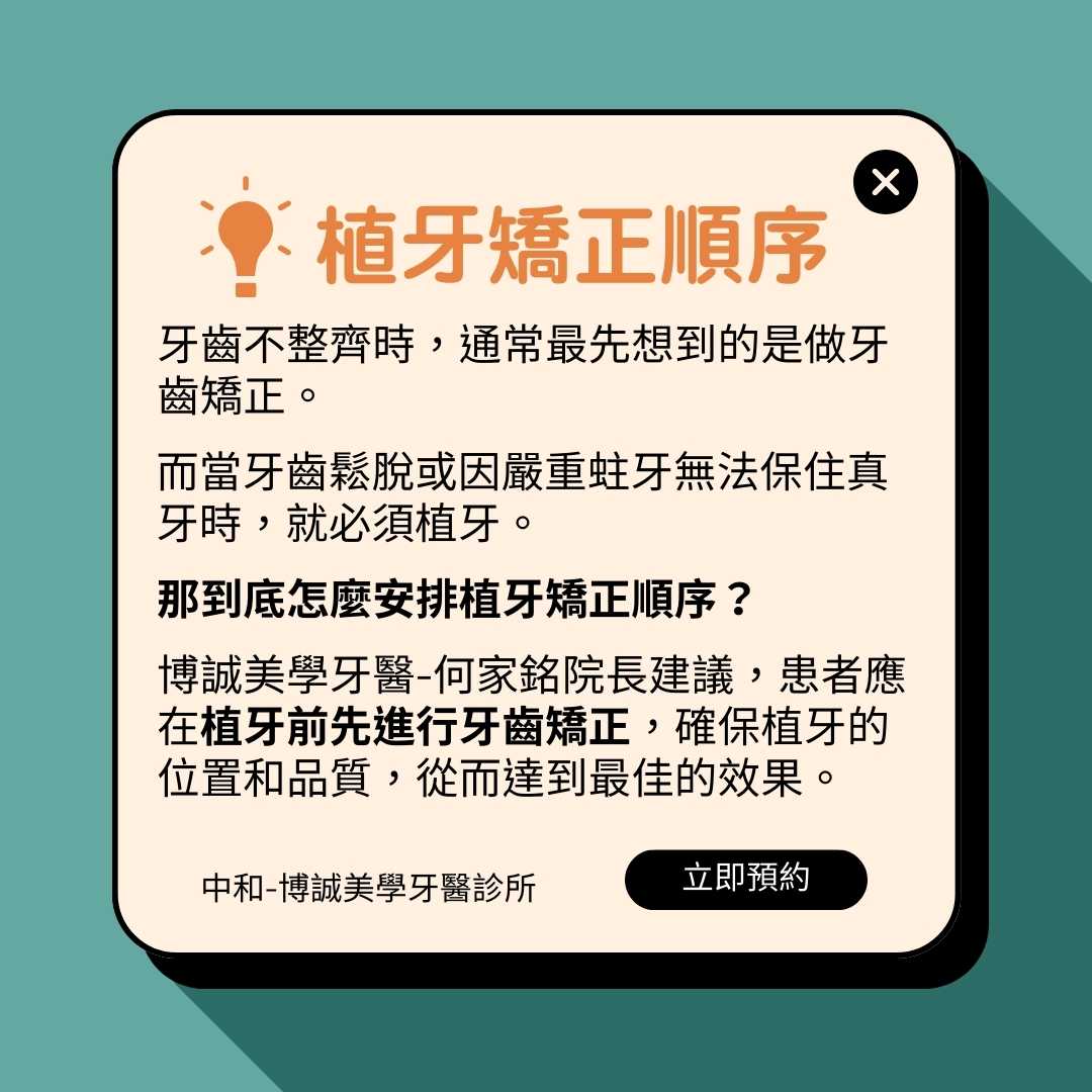 植牙矯正順序多數情況會是先矯正再植牙